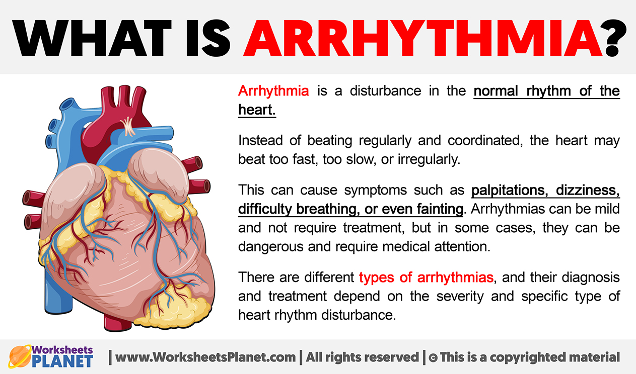 What Is Arrhythmia