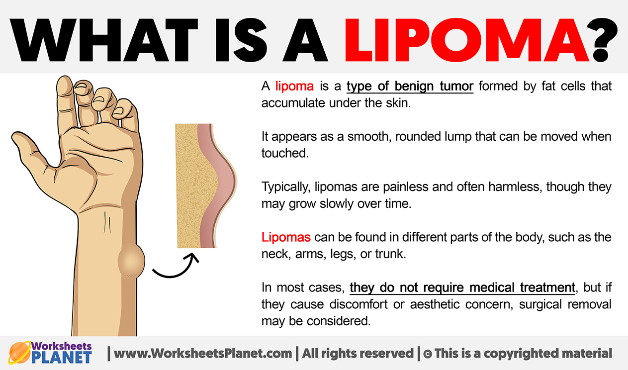 What Is A Lipoma
