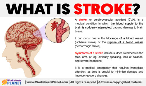 What is a Stroke | Definition of Stroke