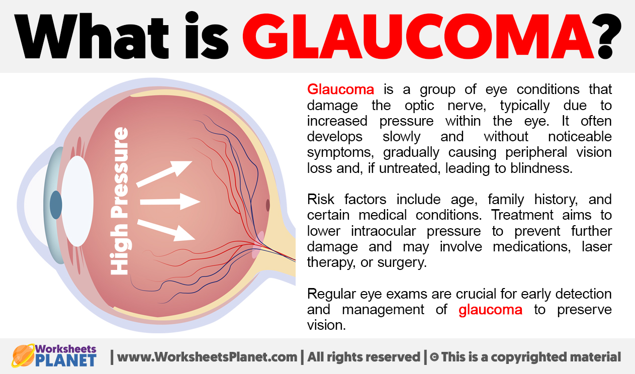 What Is Glaucoma